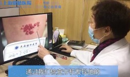 医生皮肤爆料视频大全最新,医生亲述常见皮肤病症及防治策略